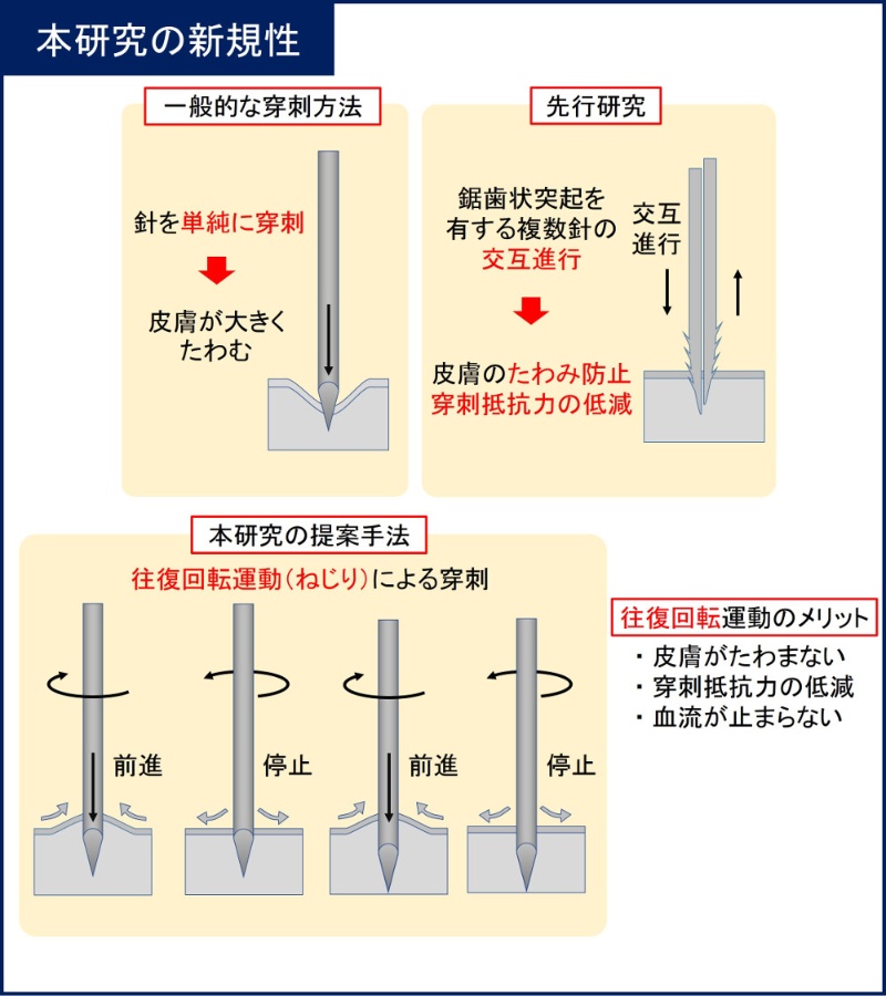 蚊をまねた 痛くない 採血に 関西大学が開発 日経クロステック Xtech 蚊をまねた 痛くない 採血に 関西大学が開発 日経クロステック Xtech