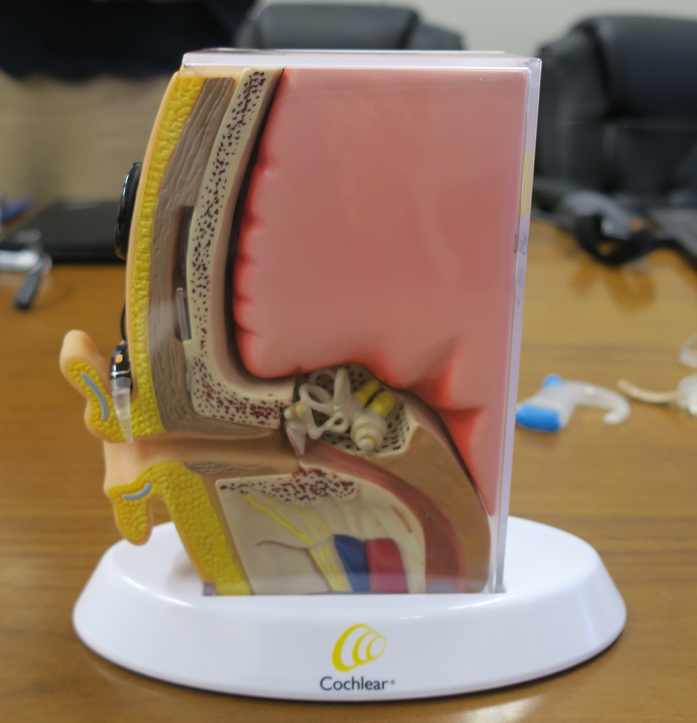 スマホにつながる人工内耳、雑音環境でも明瞭な通話を | 日経クロス