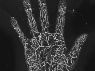 さらば造影剤、0.2ミリの微小血管まで見える光超音波技術が変える「常識」