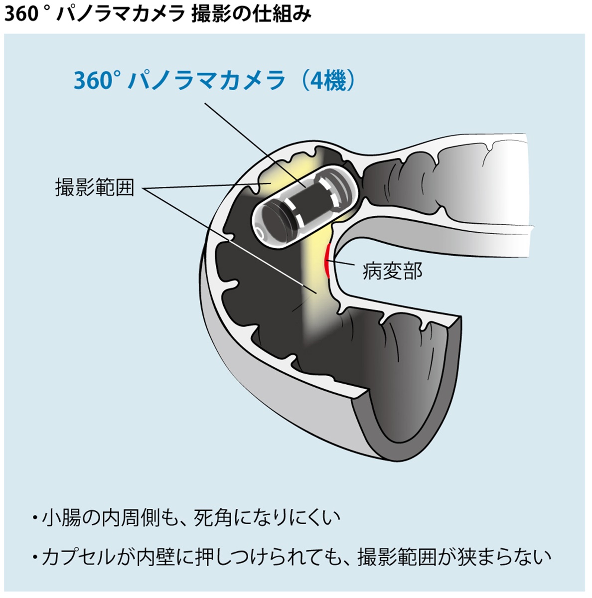360度撮影の「カプセル内視鏡」が日本進出、目指すは大腸がん検査