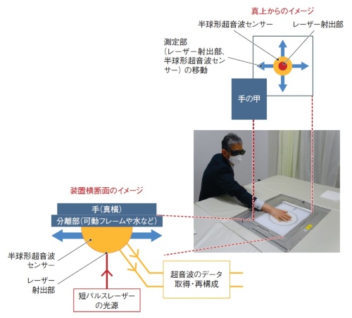図1 Luxonusが開発する光超音波イメージング装置