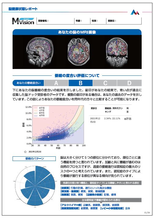 脳画像のビッグデータ分析で認知症リスクを評価、日本だから開発でき 