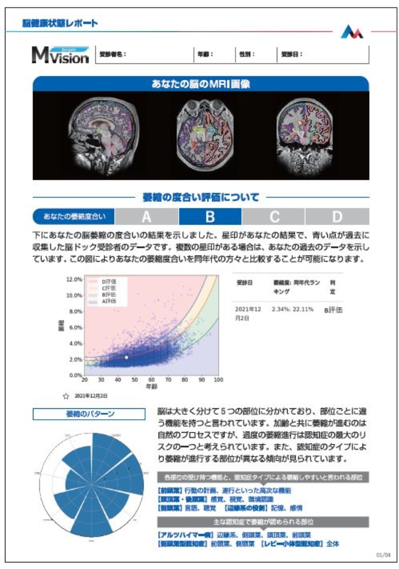 脳画像のビッグデータ分析で認知症リスクを評価 日本だから開発できたわけ 日経クロステック Xtech 脳画像のビッグデータ分析で認知症リスクを評価 日本だから開発できたわけ 日経クロステック Xtech