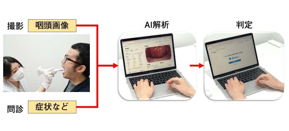 アイリスが開発したnodoca（ノドカ）の利用フロー