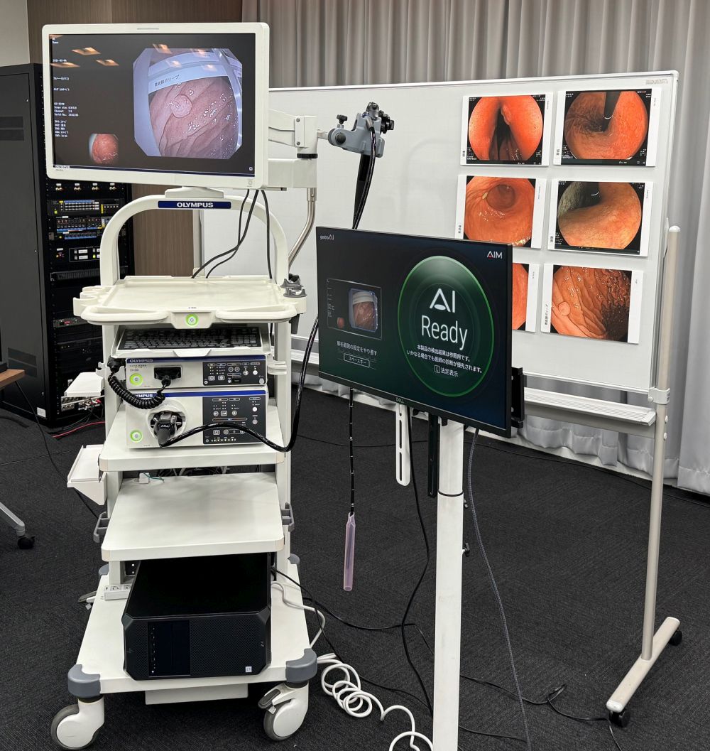 早期胃がんの見逃しを内視鏡AIで防ぐ、承認取得で苦労したAIMの診断