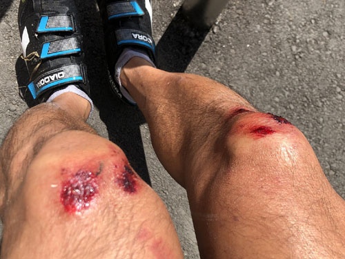 久しぶりにバイクに乗ったら落車しました。五十ヅラ下げて膝小僧を擦り剥いて面目次第もございません。