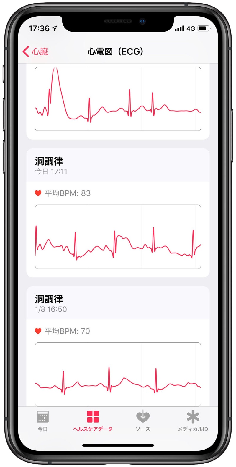 Apple Watch Series 4の心電図機能 米国版で試してみた 3ページ目 日経クロステック Xtech Apple Watch Series 4の心電図機能 米国版で試してみた 3ページ目 日経クロステック Xtech