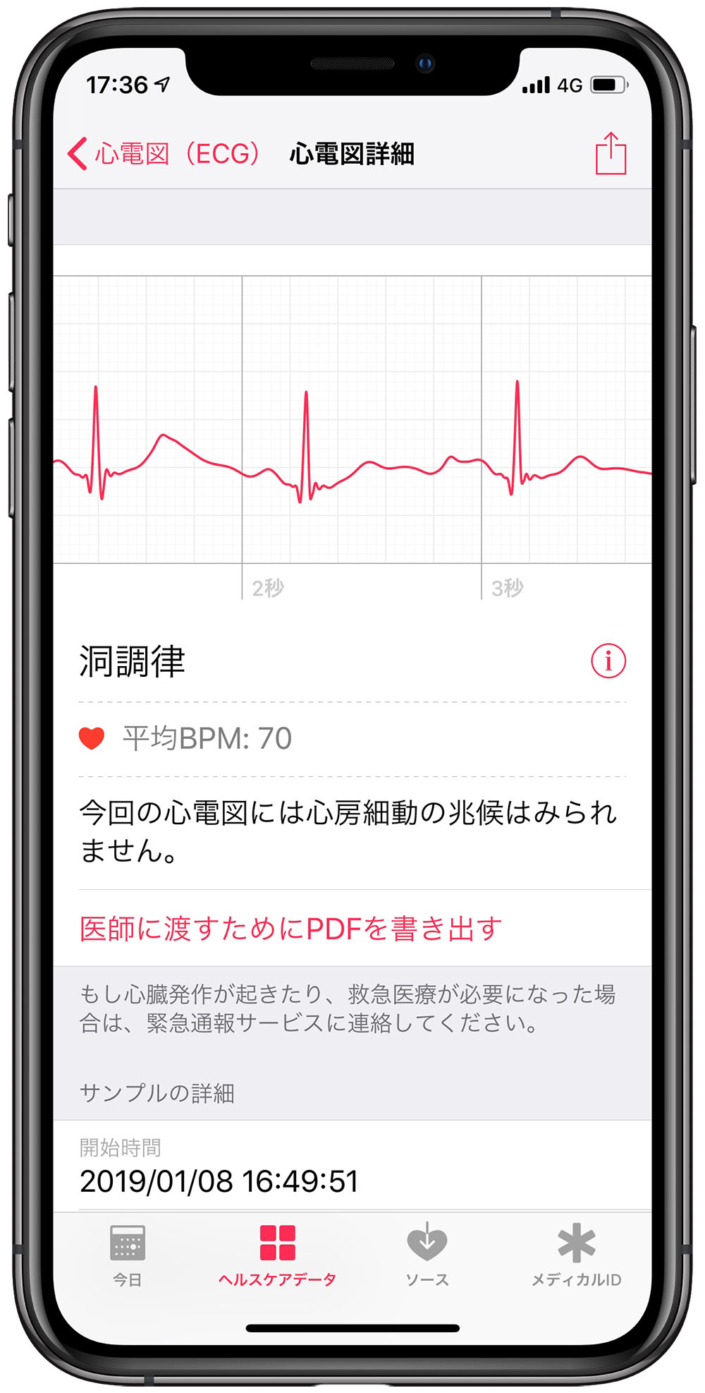 Apple Watch Series 4の心電図機能 米国版で試してみた 3ページ目 日経クロステック Xtech