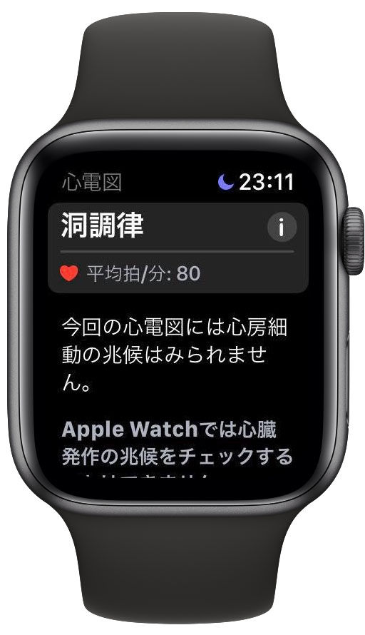 アメリカ版　Apple Watch Series 40mm 心電図