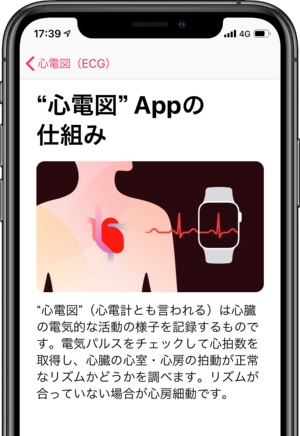 米国で医療機器として認可を受けているのは、ハードウエアとしてのApple Watchではなく、心電図アプリのほうだ