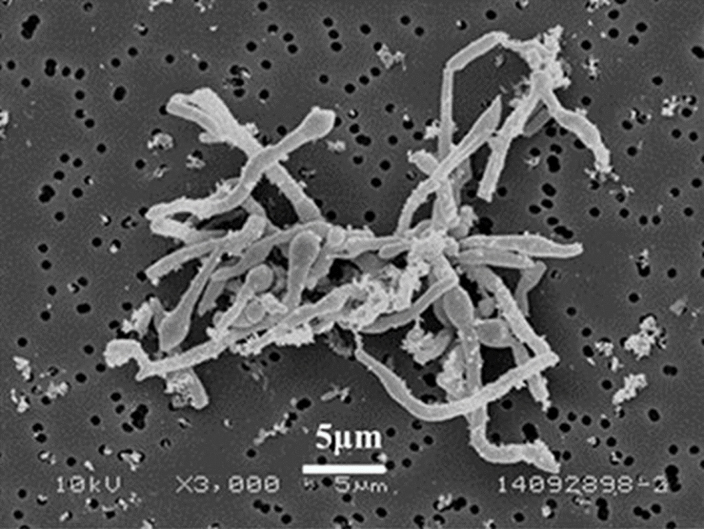 世界初の大発見、微生物が複数の地下水汚染物質を同時分解 | 日経