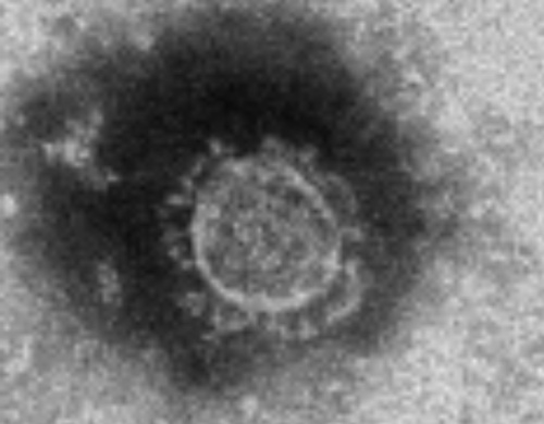 新型コロナウイルスの電子顕微鏡写真（写真：国立感染症研究所）