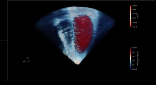 GPUを使い、心臓の2次元の超音波エコー画像から右心室の部分だけを立体化して表示