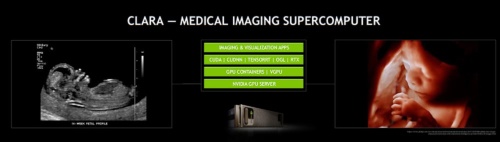 Claraは医療用の画像スーパーコンピュータ。DGX-1をベースにしたGPU仮想化サーバーで、クライアントマシンに高性能なGPU環境を提供できる