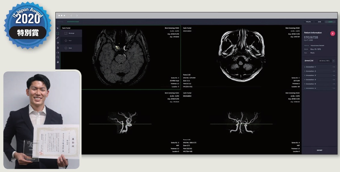 人工知能を活用した脳MRI画像解析の理論と実践 - 本