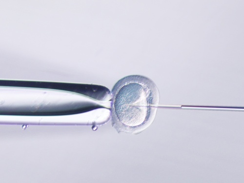 卵子に精子を注入する顕微授精作業の様子