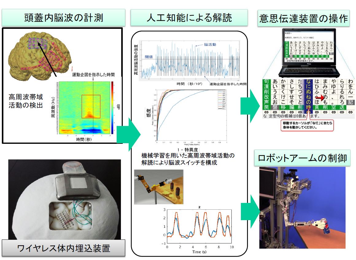 埋め込み型 低侵襲bmi で脳活動を計測 Als患者の意思伝達やリハビリに応用へ 日経クロステック Xtech