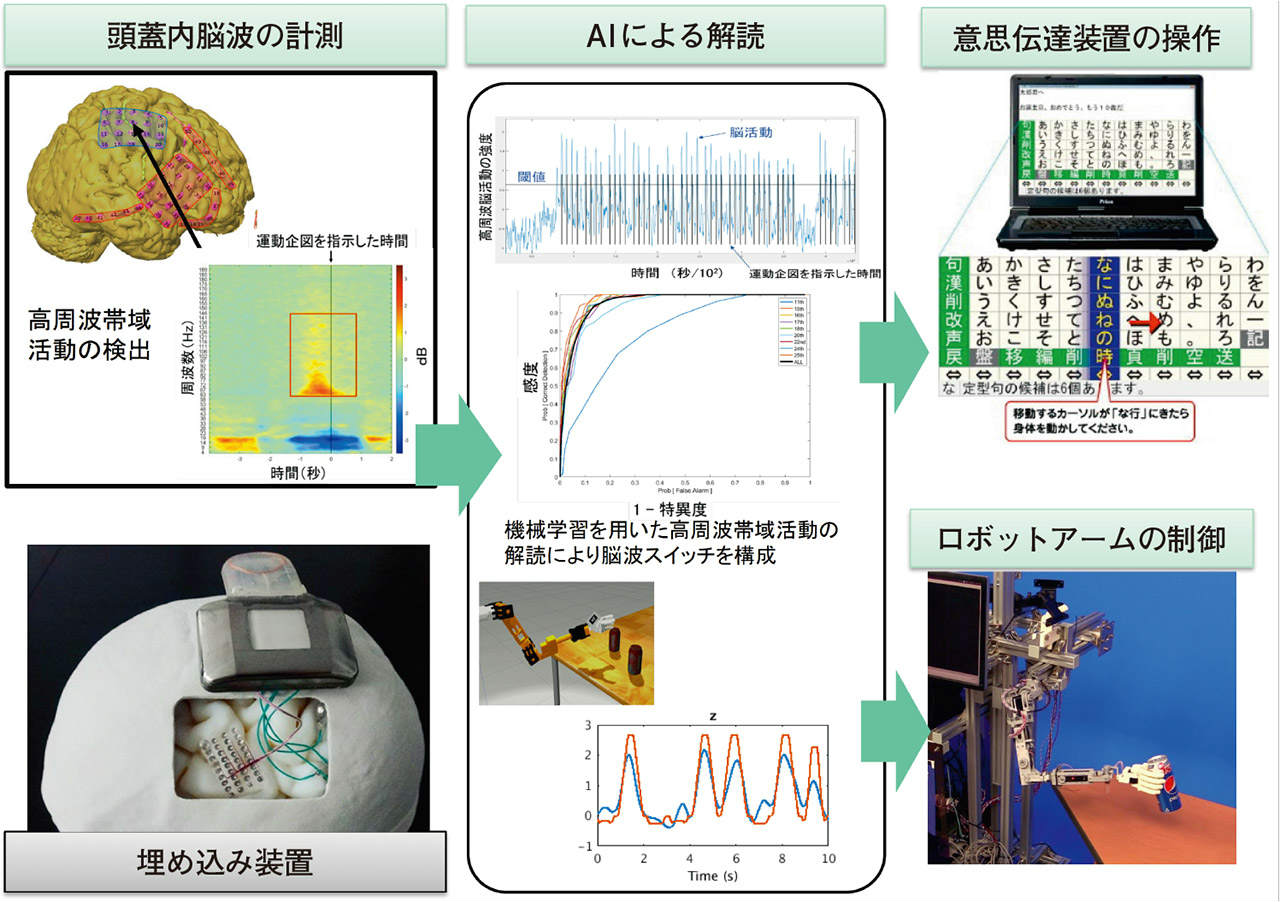 体内への電極埋め込みが視野に 局所への電気刺激で“脱薬”（2ページ目