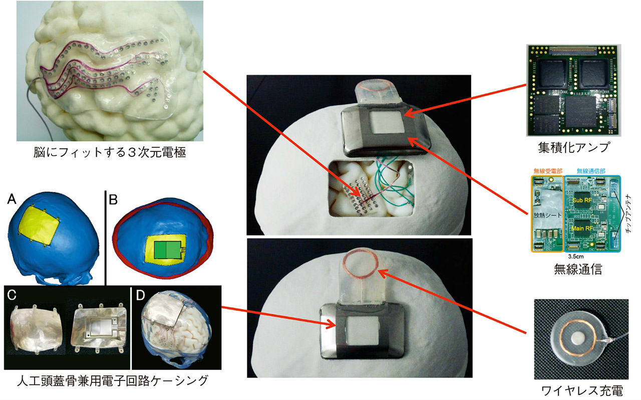 人工神経接続にシート状電極で脳計測 日本で高まる実用化機運 | 日経