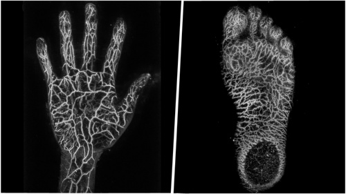 手や足の血管を撮影した画像。