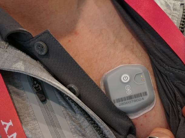 遠隔医療で利用する米BioIntelliSenseのパッチ型デバイス「BioButton」