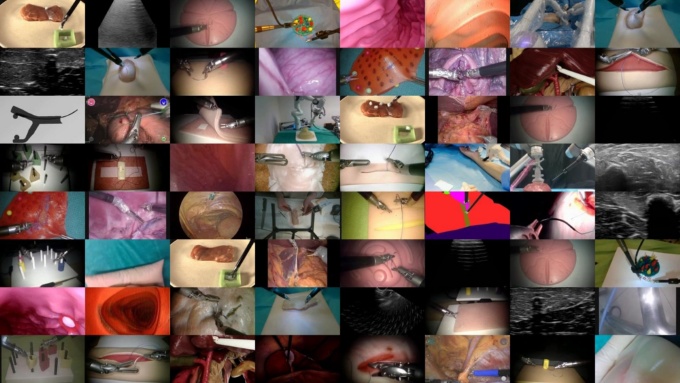 Open-Hデータセットの例