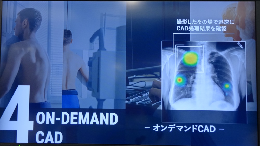 AIでX線検査時の放射線技師の業務を効率化 | 日経クロステック（xTECH）