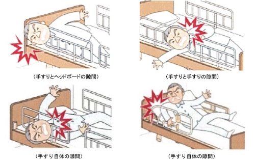 図1：介護ベッド用手すりで発生する事故の例