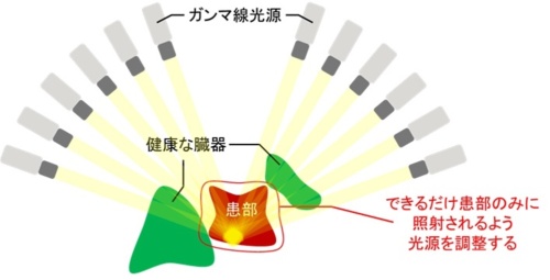 ガンマナイフ治療計画のイメージ