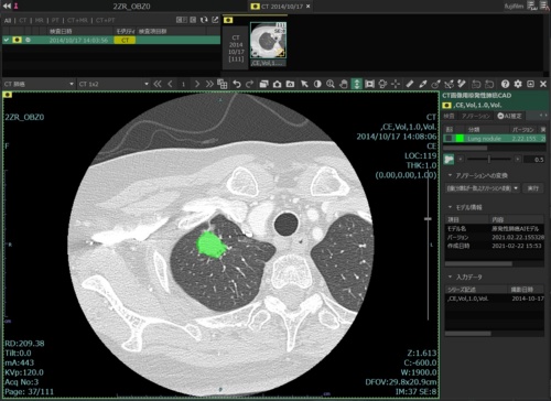 システムを使い医用画像にAIエンジンを適用した結果の画面