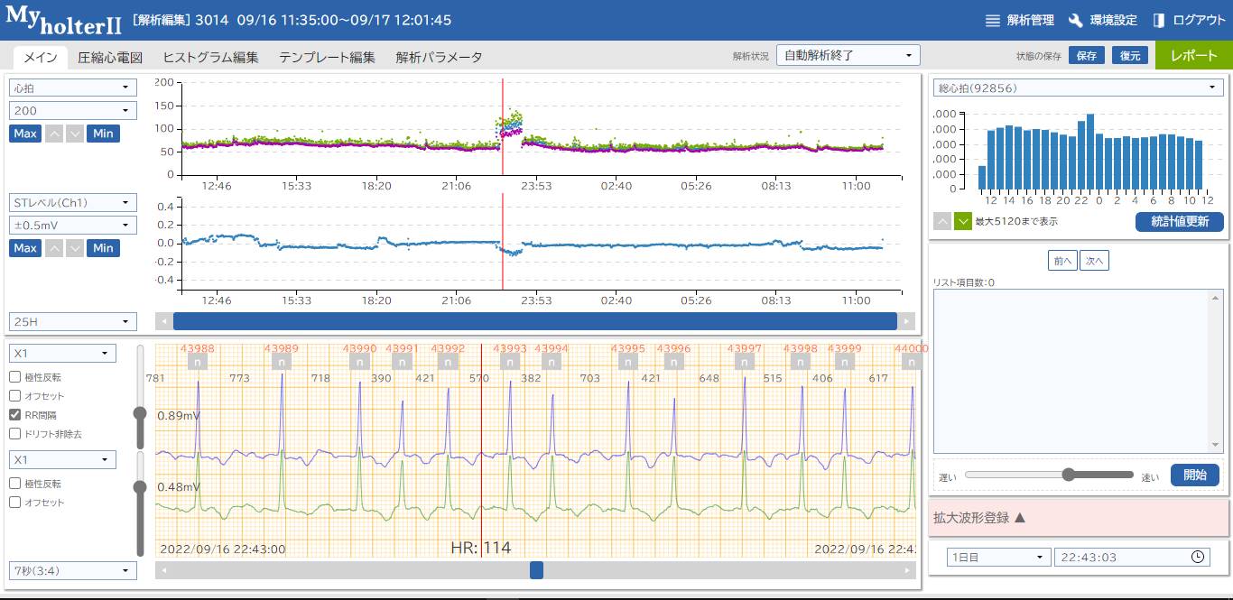 心電図のAI解析で心房細動を早期発見へ、アステラス製薬がサービス開始 | 日経クロステック（xTECH）