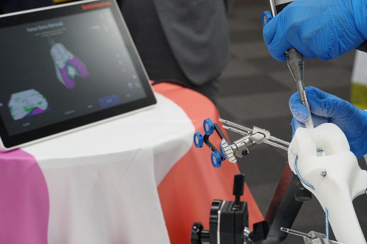 整形外科領域の新しい手術支援ロボット登場、靭帯を温存する高