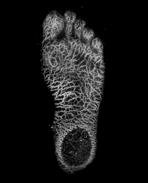 光超音波イメージング装置で足の裏を撮影した様子。張り巡らされた血管の血流状態を確認できる