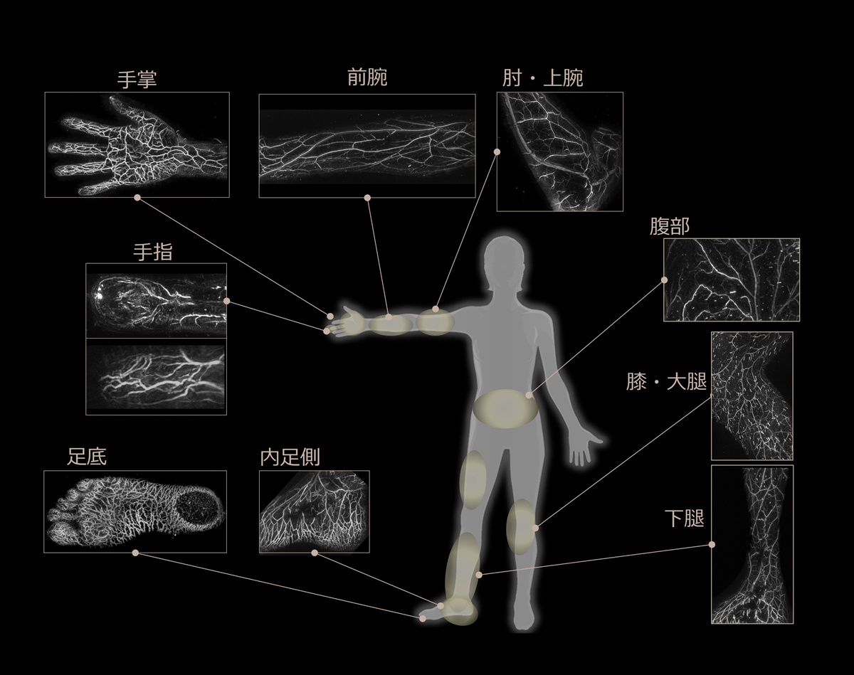 光超音波イメージング装置で様々な部位を撮影した画像。造影剤を使用せずに血流が見える （出所：Luxonus）