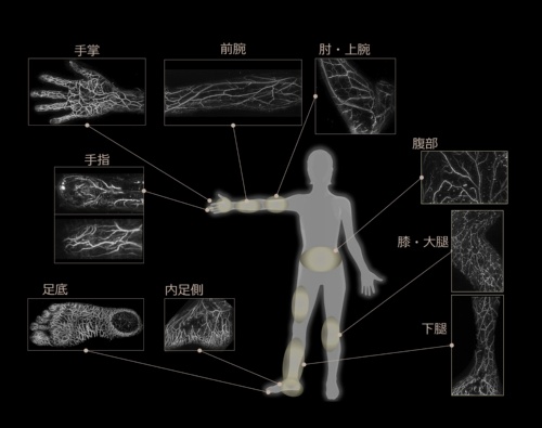 光超音波イメージング装置で様々な部位を撮影した画像。造影剤を使用せずに血流が見える