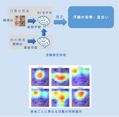 むくみ推定技術の概要