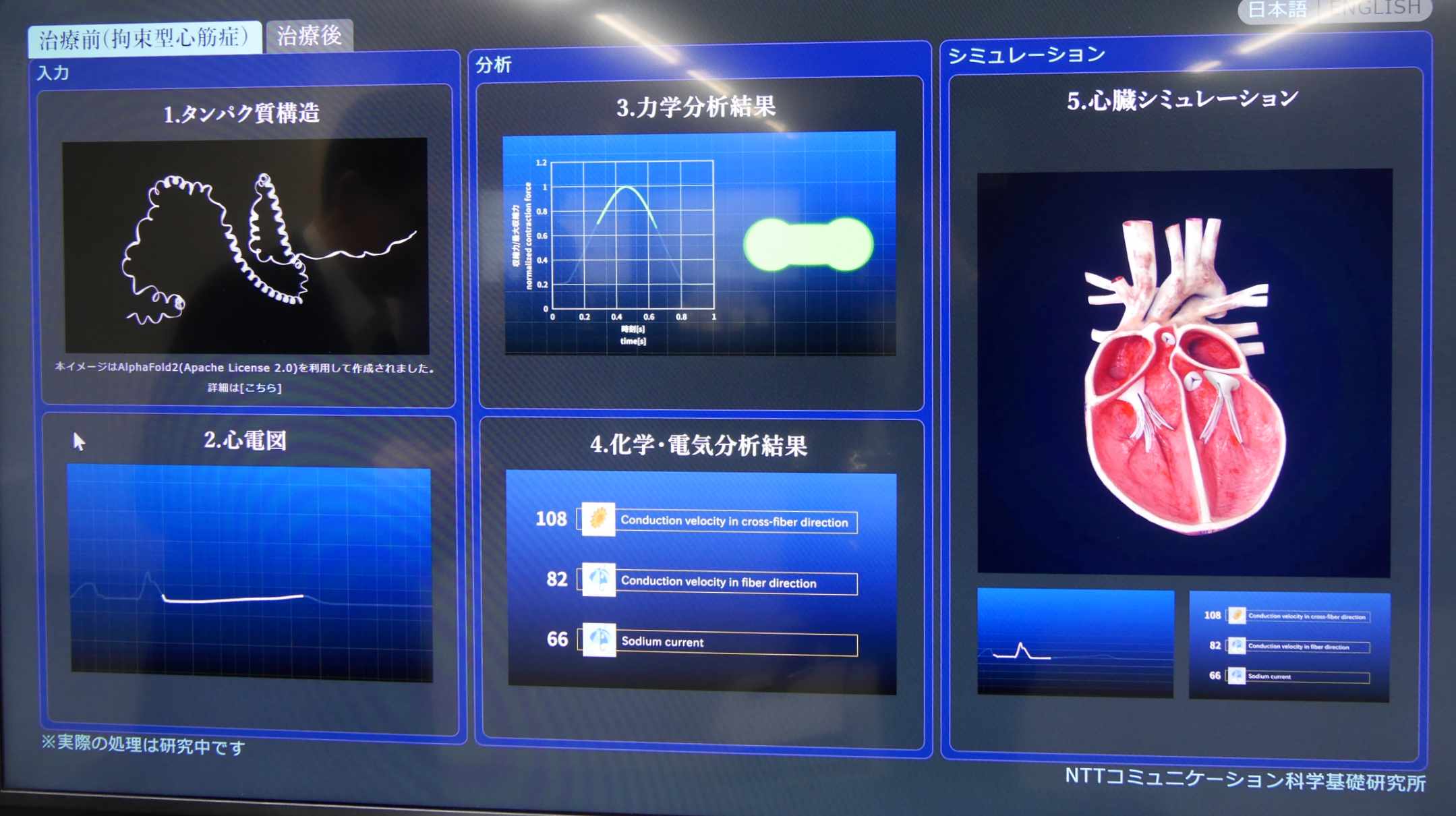 NTTと大阪大が心筋細胞伸縮の高精度測定技術、心臓病治療に期待 | 日経